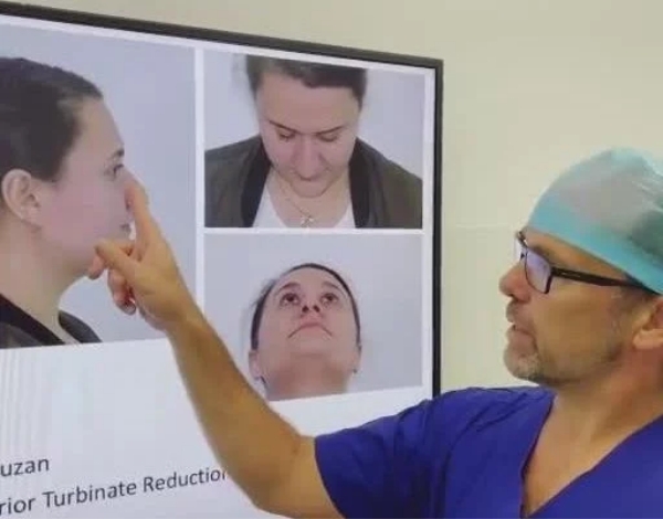 Choosing a Nose Surgeon or Rhinoplasty Surgeon in Sydney 3 best nose surgery sydney - best nose surgeon sydney