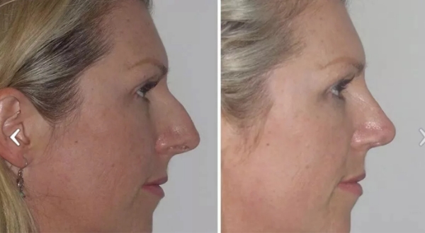 Roman - Dr Jeremy Hunt Leading face surgeon